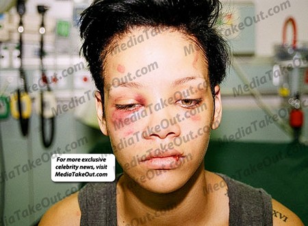 A beaten Rihanna